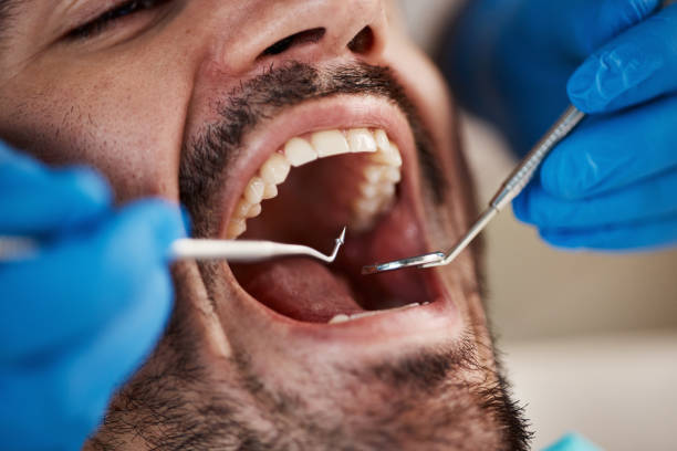 Best Chipped Tooth Repair Near Me  in Eastvale, CA